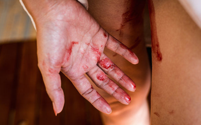 Period blood colours: What is normal?